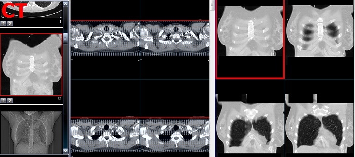 Was wird bei CT Thorax abgebildet